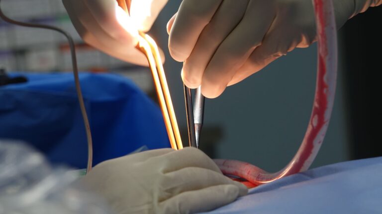 Does General Anesthesia Cause Dementia? What Research Actually Shows - Featured image