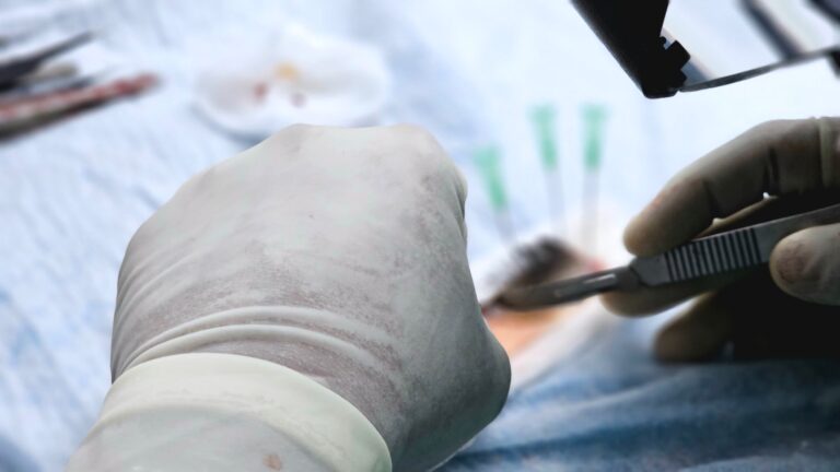 Surgical Options for Encephalomalacia: When Are They Necessary? - Featured image