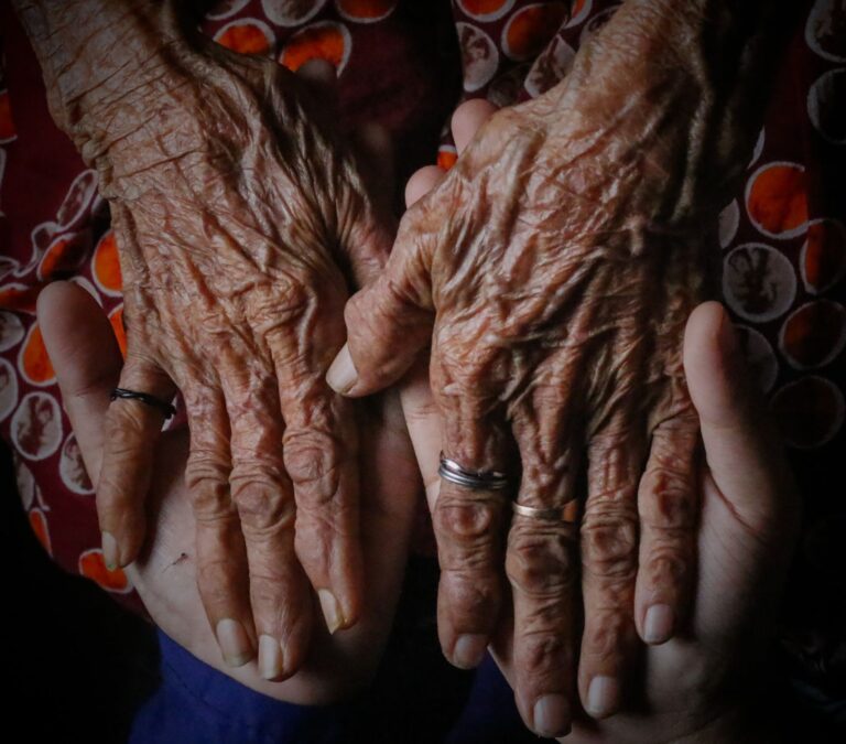 Aricept Monitoring Checklist for Alzheimer's Patients and Caregivers - Featured image