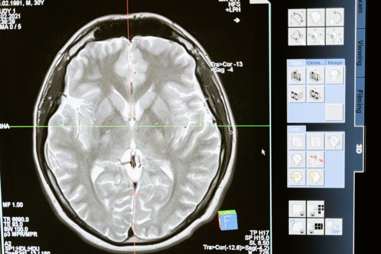 Before Getting a Neurological Examination for Alzheimer's: Benefits and Limitations - Featured image