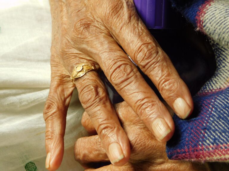 How Dementia Stage Changes the Approach to Repeated Questions - Featured image
