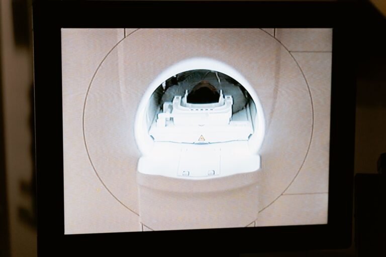 MRI Monitoring With At-Home Leqembi: What Alzheimer's Patients Still Need - Featured image