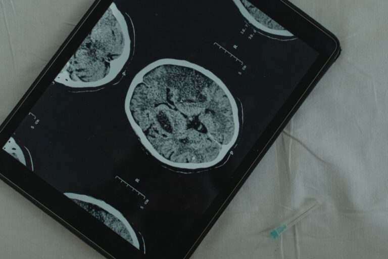 What Does the Neurological Examination Show in an Alzheimer's Evaluation? - Featured image